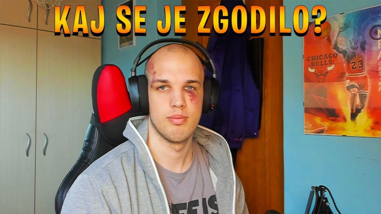 Slovenski streamer ScorpLZ pretepen v resničnem življenju zaradi spora v igri Counter-Strike