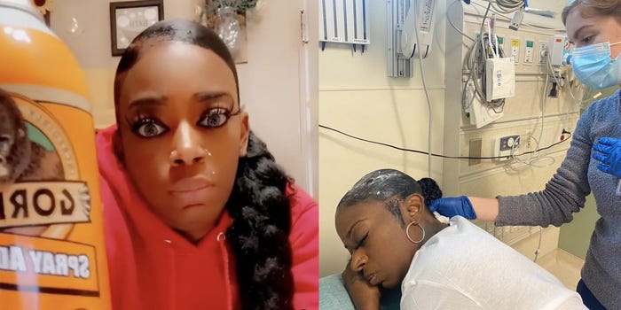 Ženska, ki si je po nesreči v lase nanesla superlepilo, preko noči postala zvezdnica Instagrama